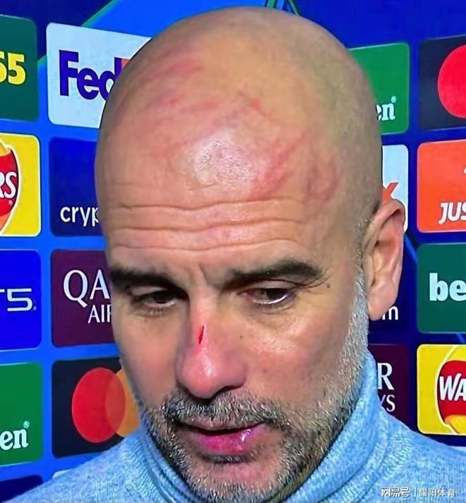 赛前费耶诺德备战英超西汉姆赛后防线松动，连对手都承认：赛后尼斯伤情更新的简单介绍